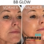 BB Glow on-site training incl. starter set & certificate