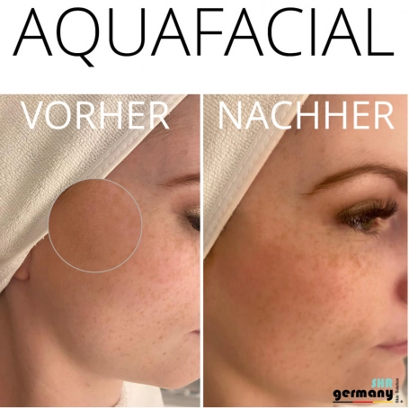 Aquafacial Kurs mit Gerät Kosmetik Schulung selling AQUA FACIAL SCHULUNG