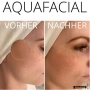 Aqua Facial training Incl. training documents & certificate