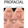 ProFacial on-site training Incl. training documents & certificate